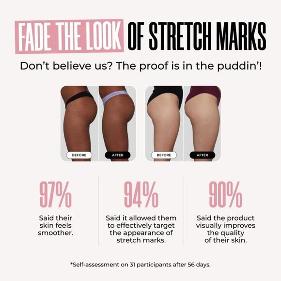 Maely’s B Sleek Outer Thigh Stretch Mark Cream! - Picture 5 of 9